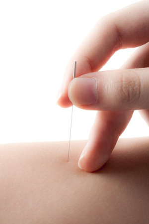 accupunture-img